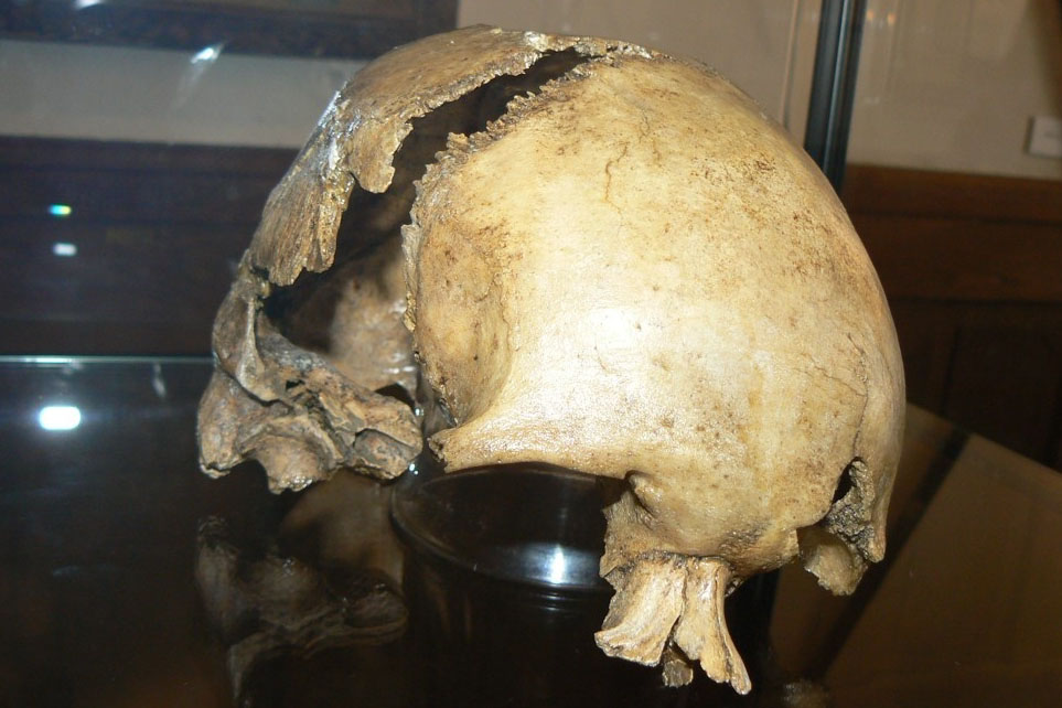 „Čáslavskou kalvu“ Jana Žižky z Trocnova prozkoumal počítačový tomograf