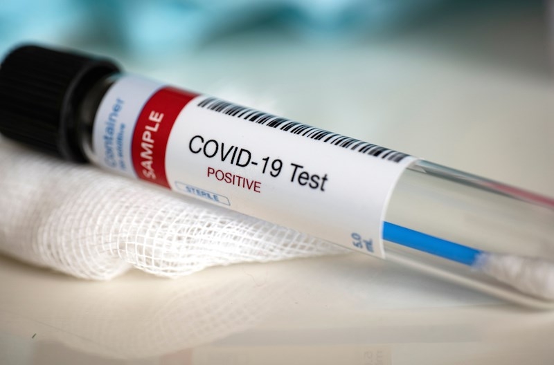 Lékařka kolínské nemocnice měla pozitivní test na Covid-19